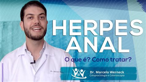 herpes anal-1